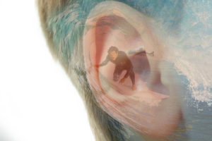 surfers-ear