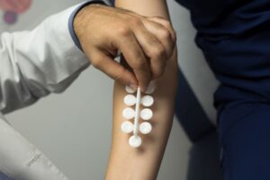 Read more about the article Allergy Testing – Drops/Shots