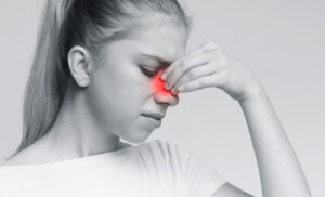 Nasal Polyps