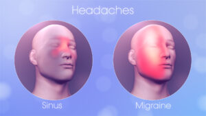 Sinus Headaches vs. Migraines